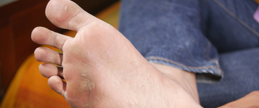Cuidado de los pies masculinos: pasos simples para unos pies saludables y libres de problemas