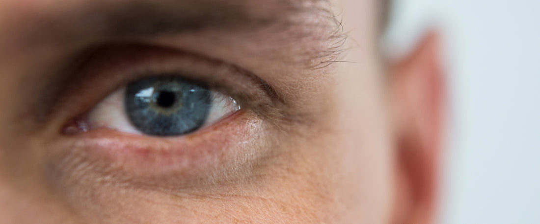 Despertando sin rastro de ojeras: Cómo combatirlas y lucir una mirada impecable
